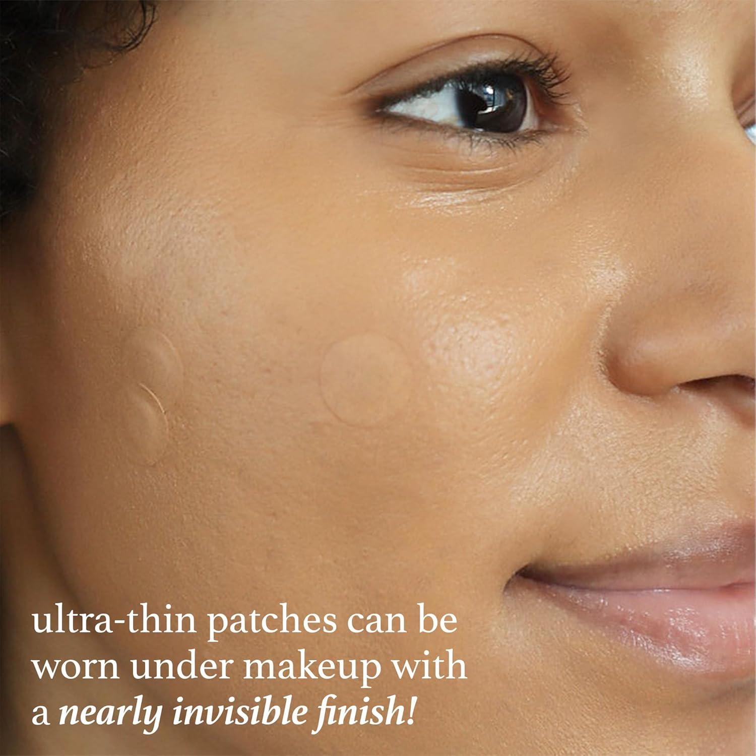 Parche Hidrocoloide Julep Me Up para Acné - 72 Piezas