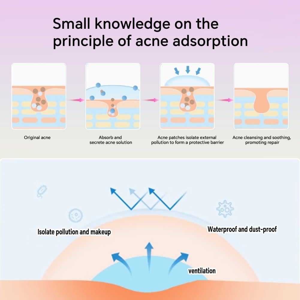 Parche para Granos Loske - 6 Tamaños, Hidrocoloide con Aceite de Árbol de Té