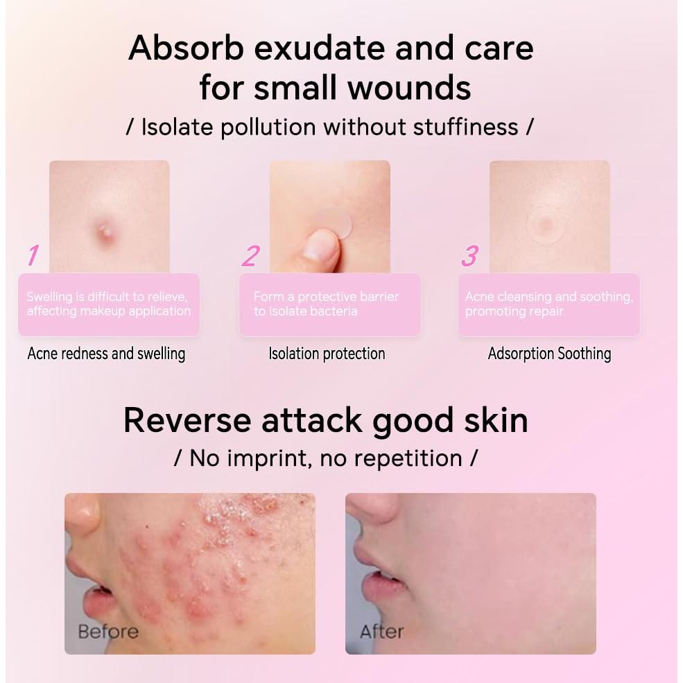 Parche para Granos Loske - 6 Tamaños, Hidrocoloide con Aceite de Árbol de Té