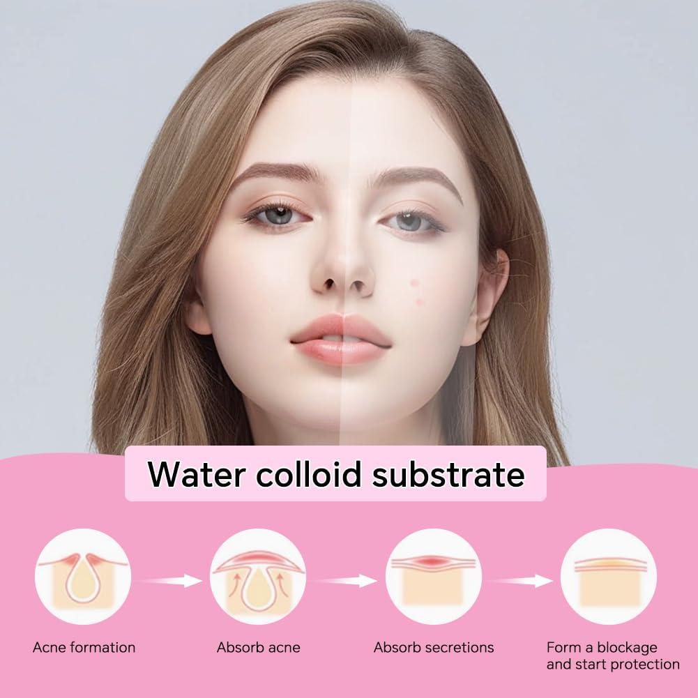 Parche para Granos Loske - 6 Tamaños, Hidrocoloide con Aceite de Árbol de Té