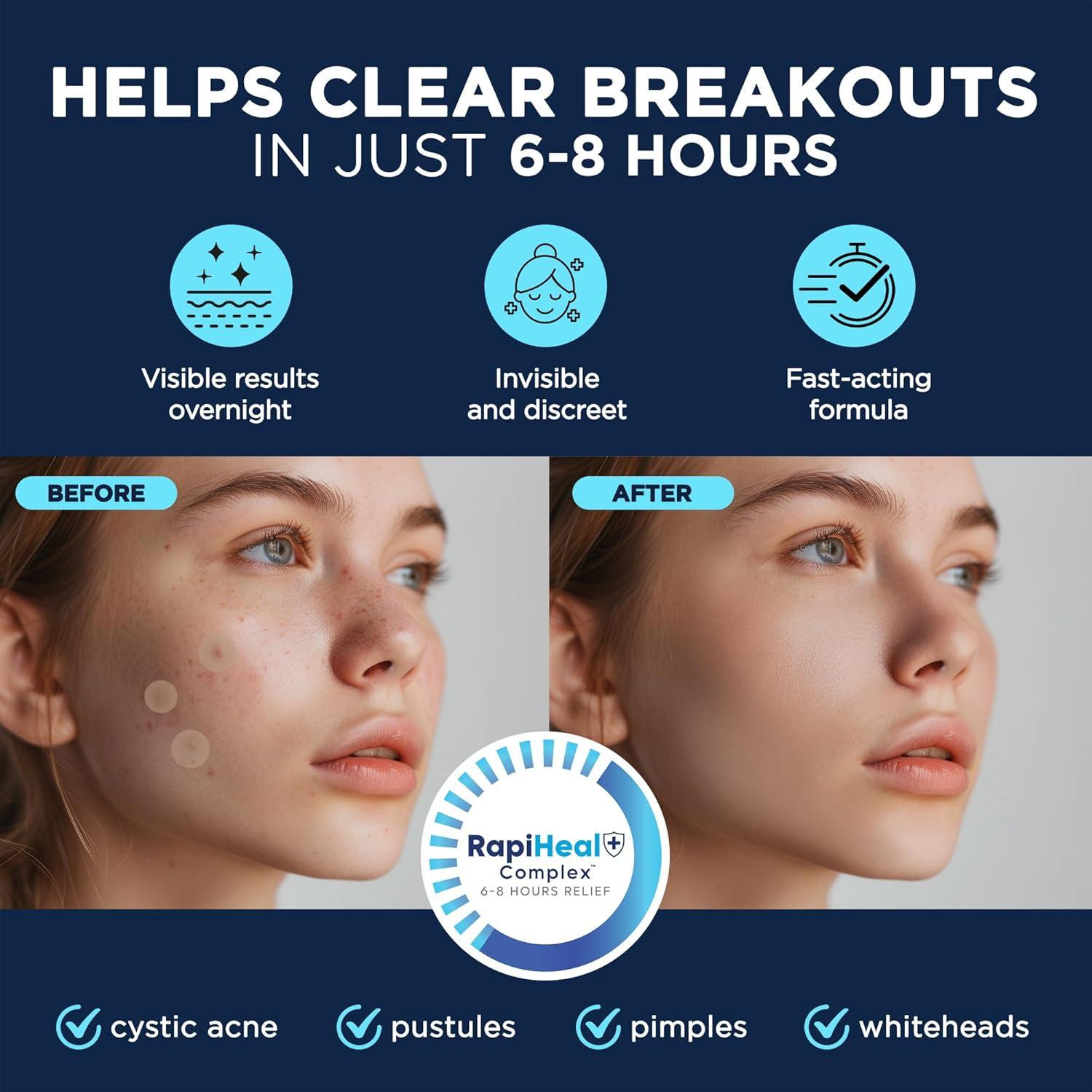 Parche Hidrocoloide para Granos Dura Cleanse - 134 Unidades