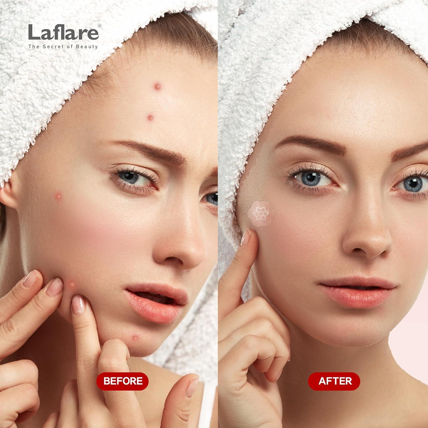 Parche de Magnesio Laflare para Acné y Manchas Oscuras - 10 Piezas