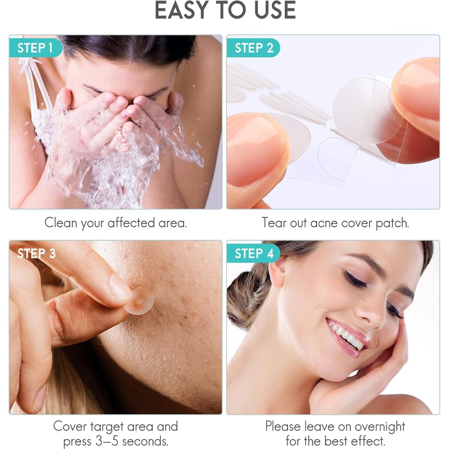 Parche hidrocoloide AOAWI para acné y granos, 350 piezas