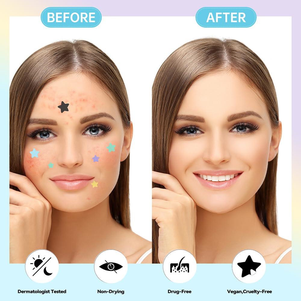 Parche Hidrocoloide Estrella Linda MISMALS 280 Unidades Piel