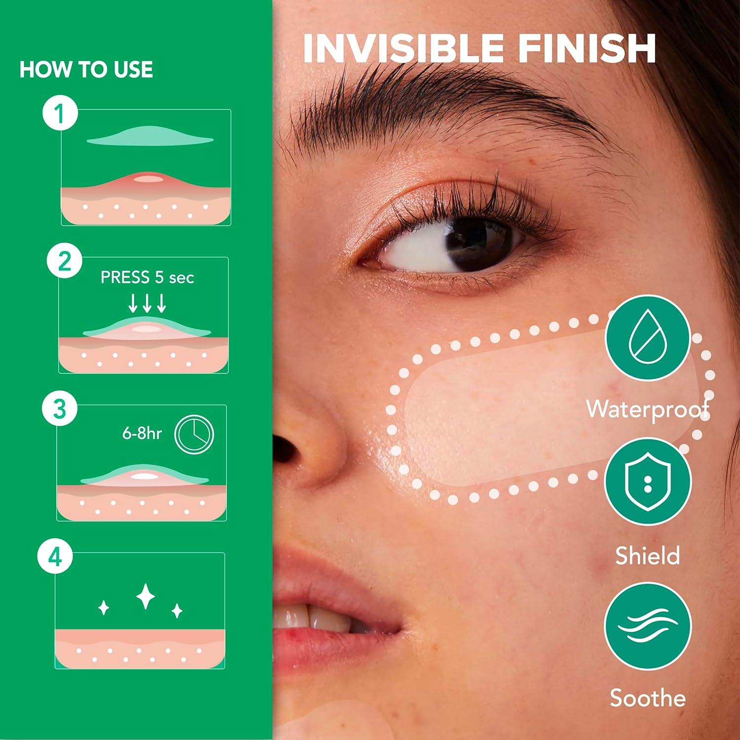 Parche para Imperfecciones SoloVegan 55pcs Hidrocoloide