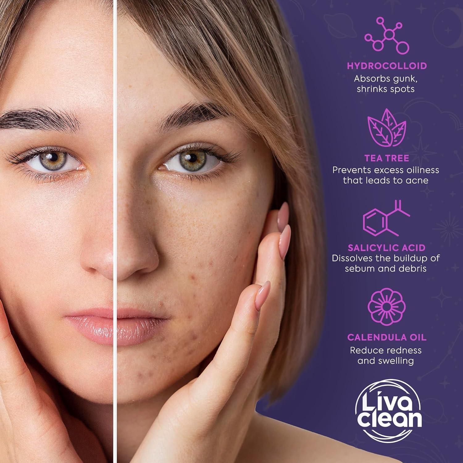 Parches para Granitos LivaClean 512 Unidades Hidrocoloides