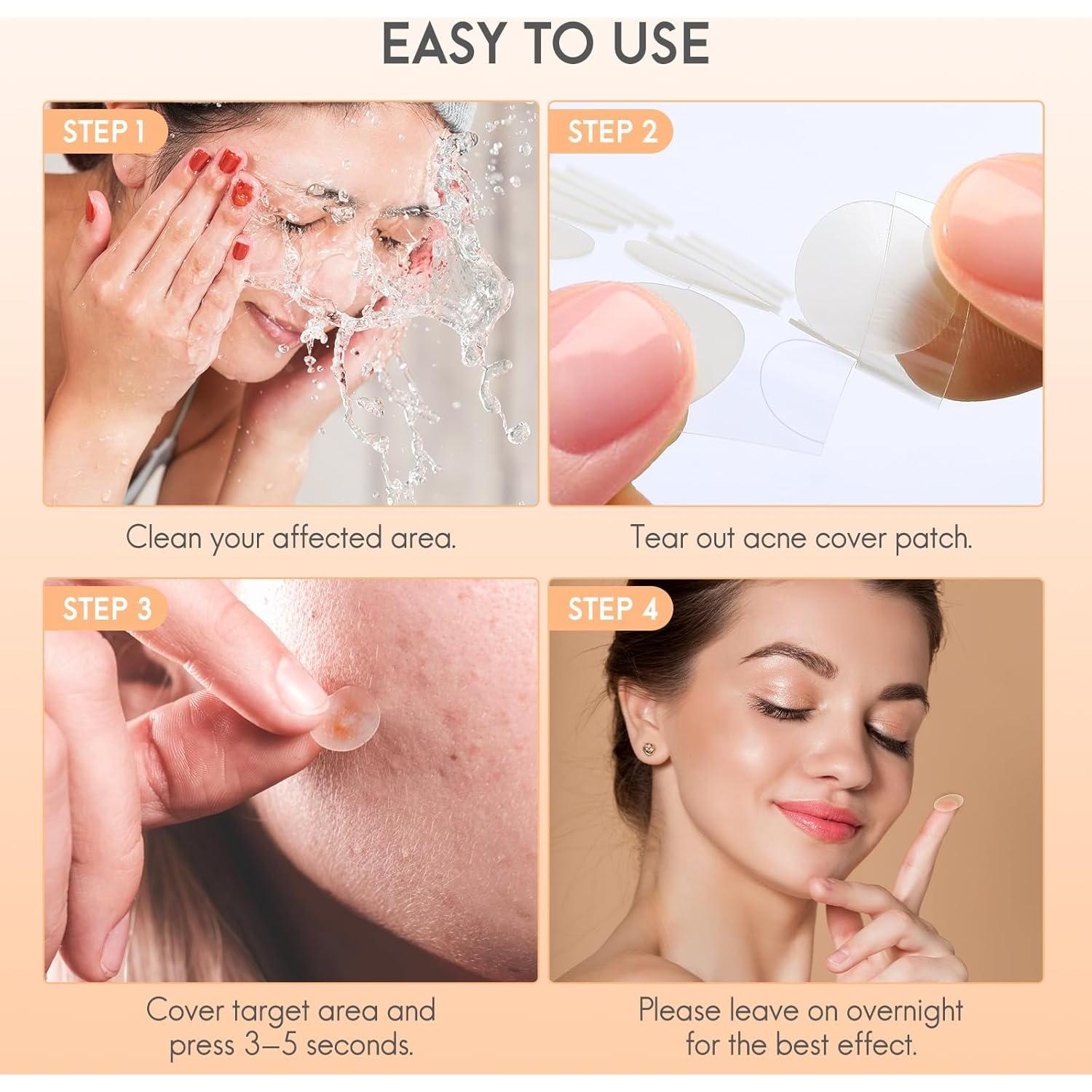 Parche Hidrocoloide para Acné AOAWI - 182 Piezas, 4 Tamaños