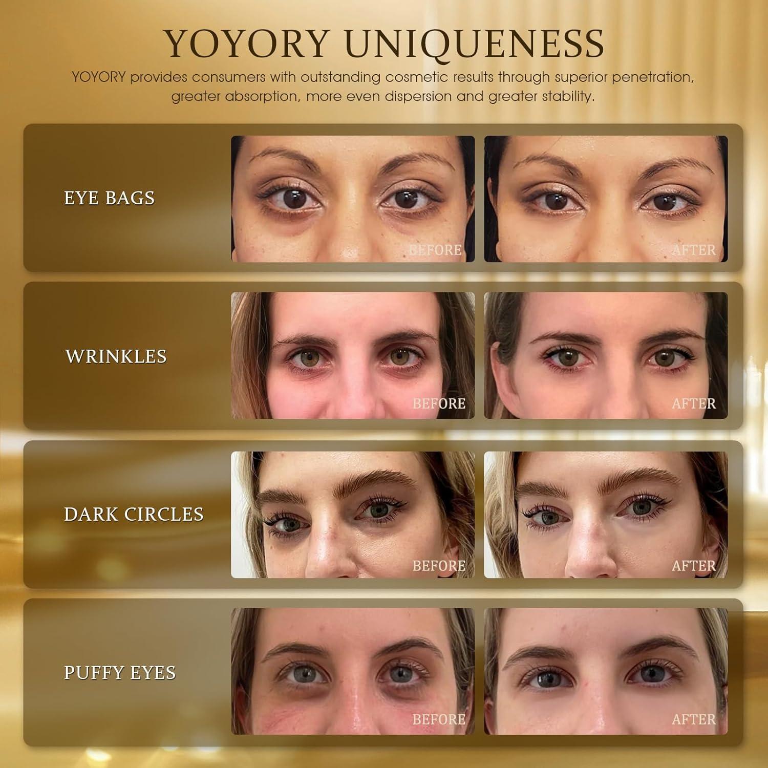 Parche Hidrogel para Ojos YOYORY - 60 Pcs Colágeno y Ácido Hialurónico