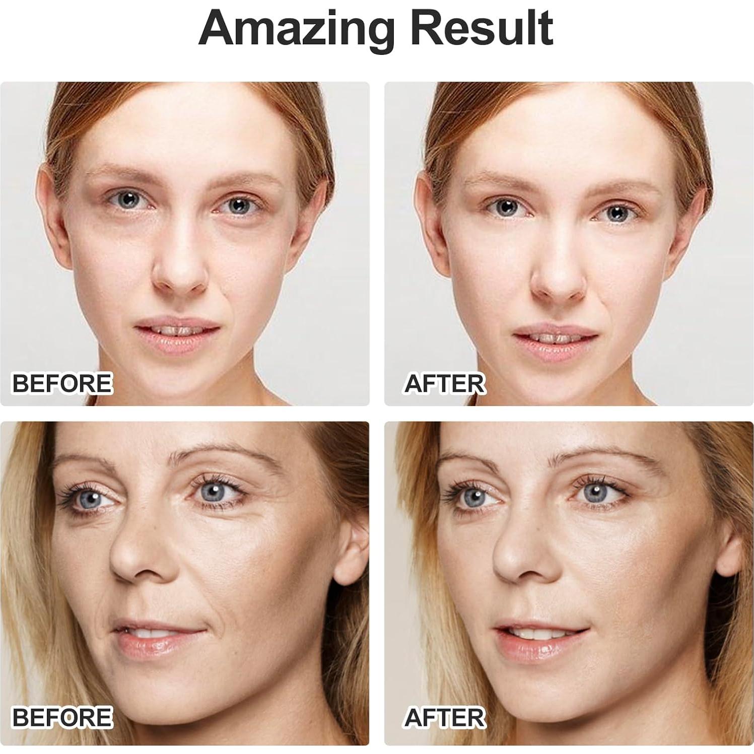 Gua Sha Terahertz ZminRN para Cara y Cuerpo - Masajeador Facial