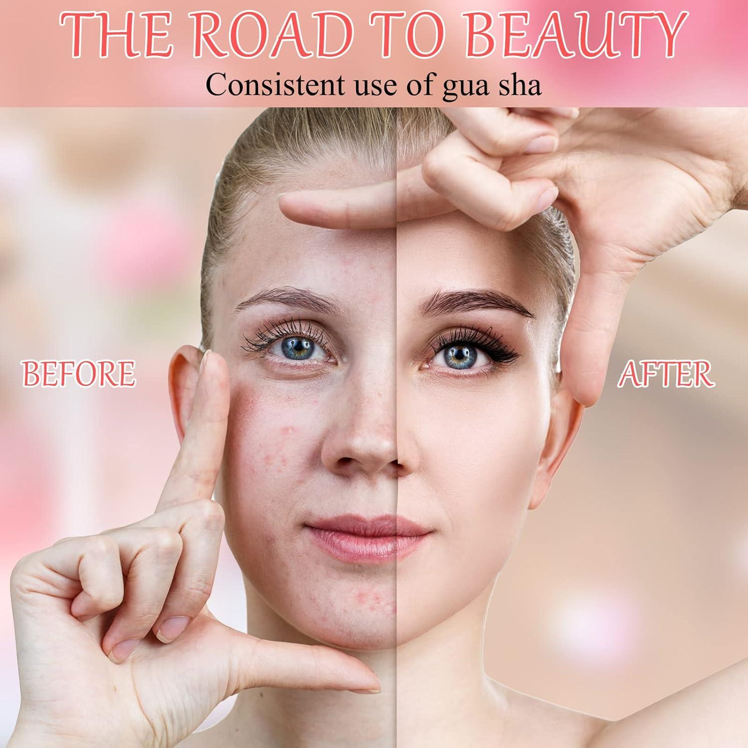 Set 24 Piezas Gua Sha Facial Sherr - Masaje en Colores