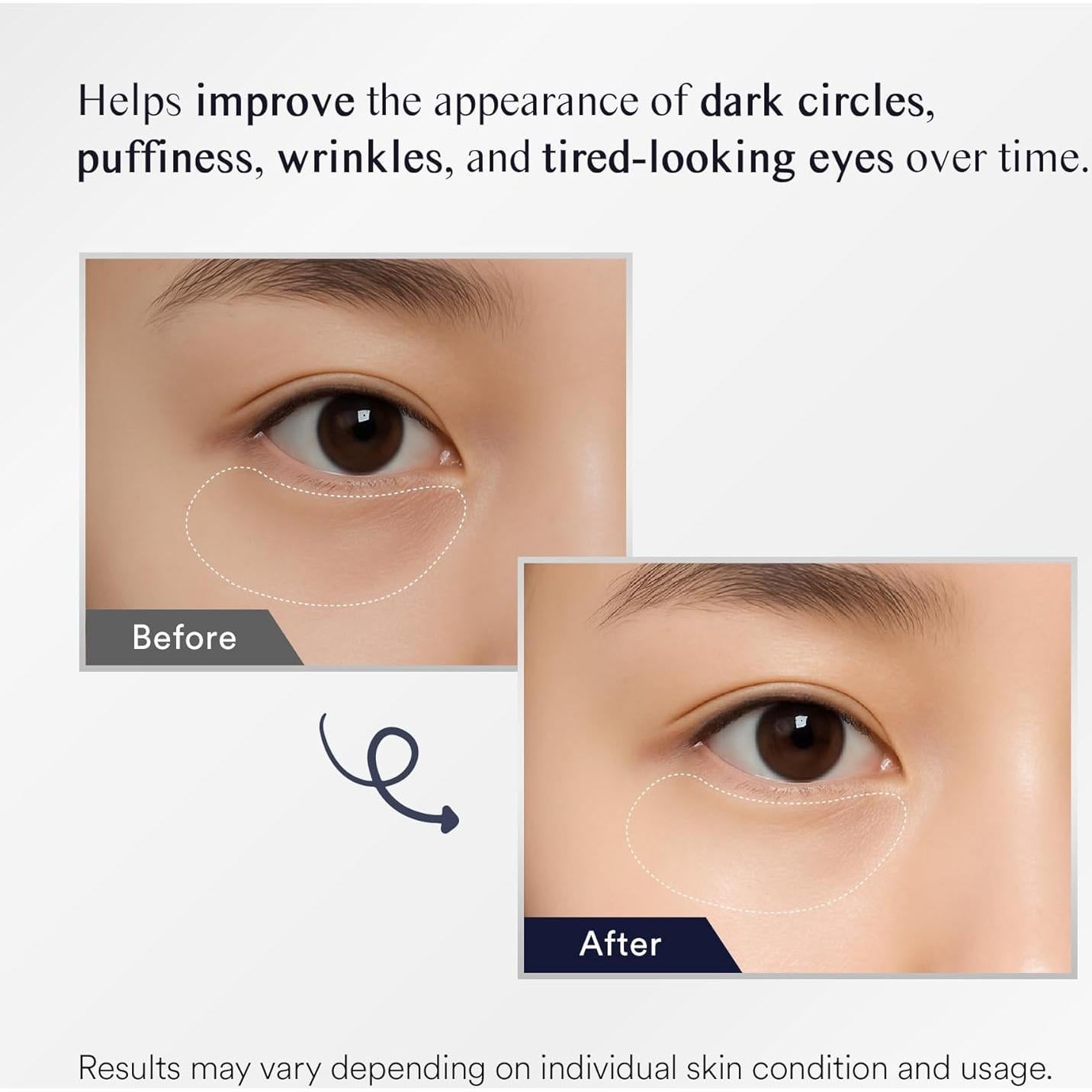 Parche para Ojos Uikeaft - 30 Pares Hidrogel Antiarrugas con Colágeno y Retinol