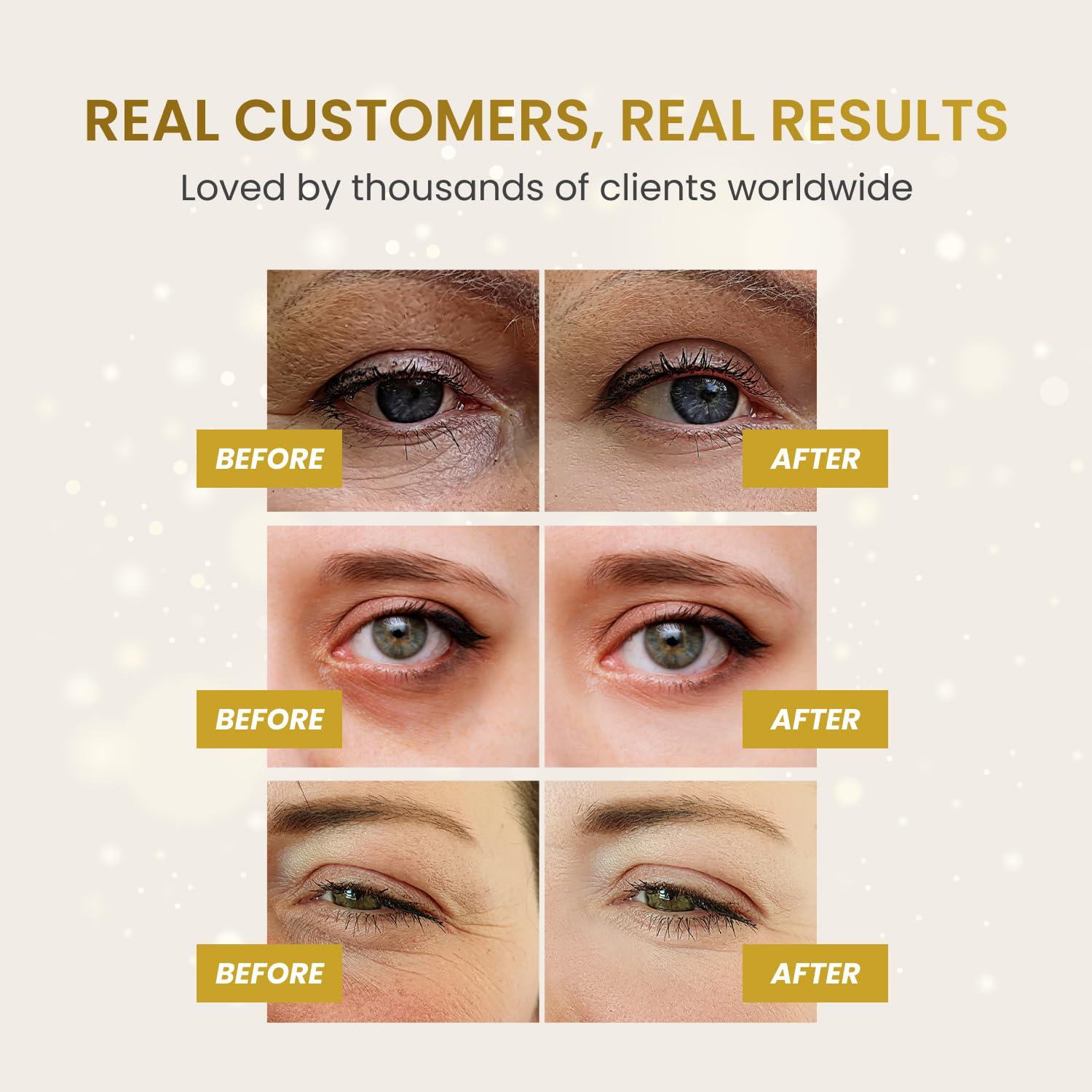 Parche de Ojos Dorado Plantifique | 20 Pares | Hidratante y Revitalizante