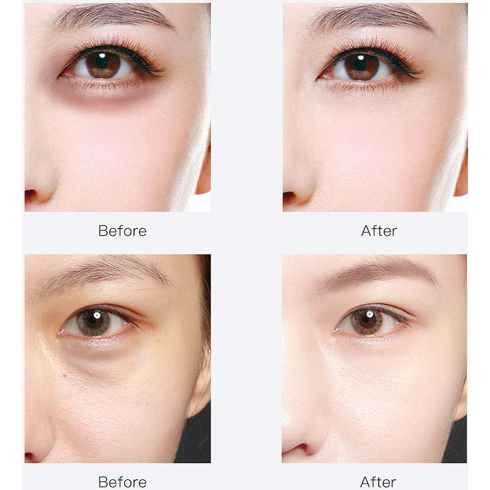 Máscaras para Ojos RABIOTA - 30 Pares con Ácido Hialurónico