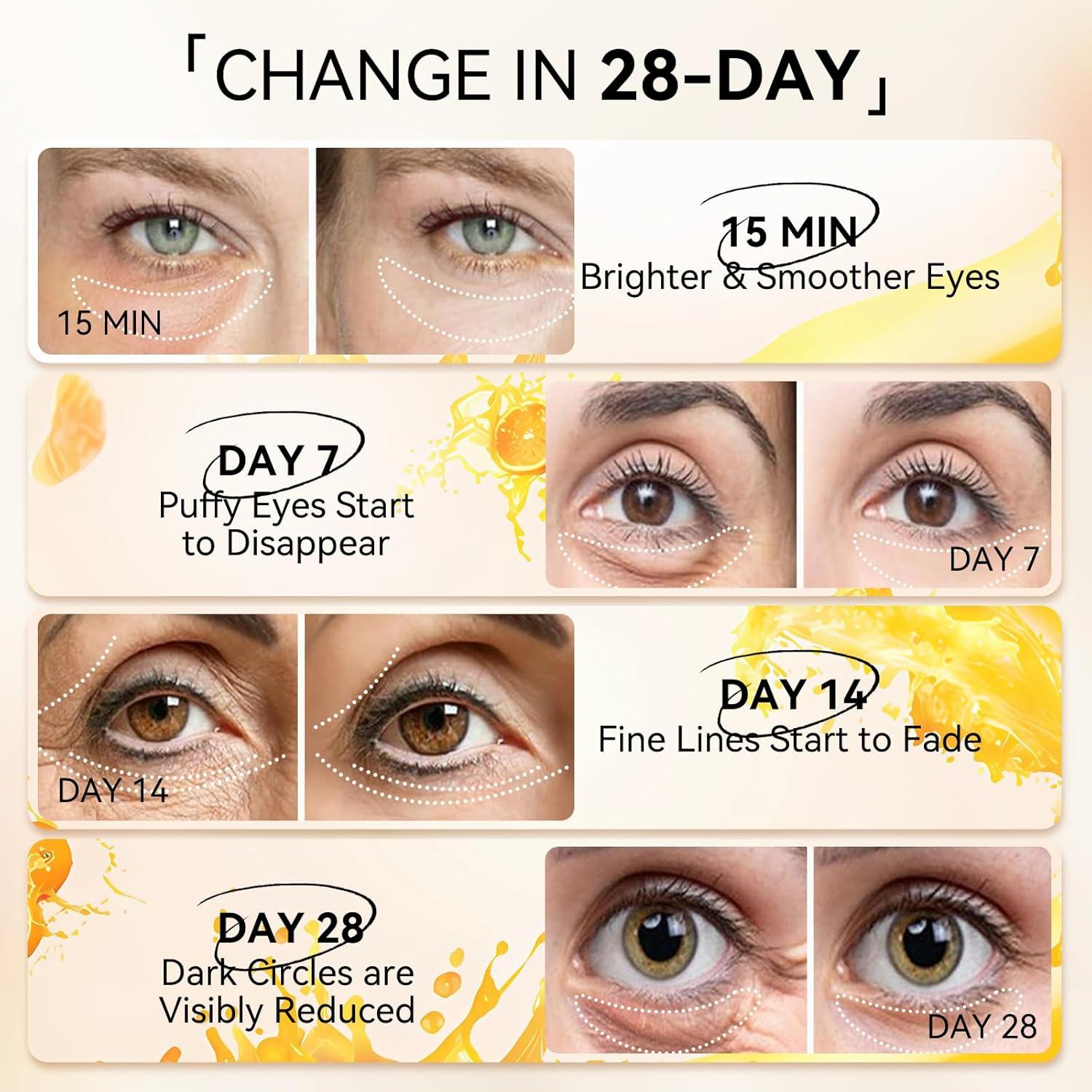 Parches para Ojos LANBENA con Vitamina C - 30 Pares Hidratantes