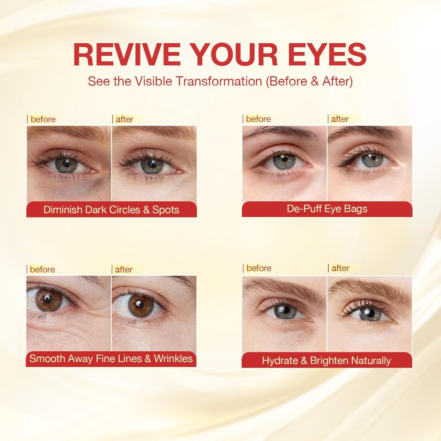 Parche para Ojos GONIM 360° con Colágeno y Retinol - 15 Piezas