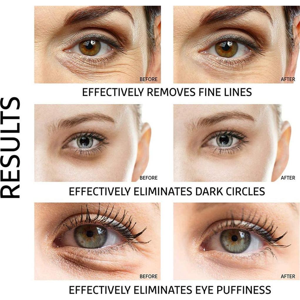 Parche para Ojos Ruzzut - 30 Pares Hidratantes de Colágeno Oro