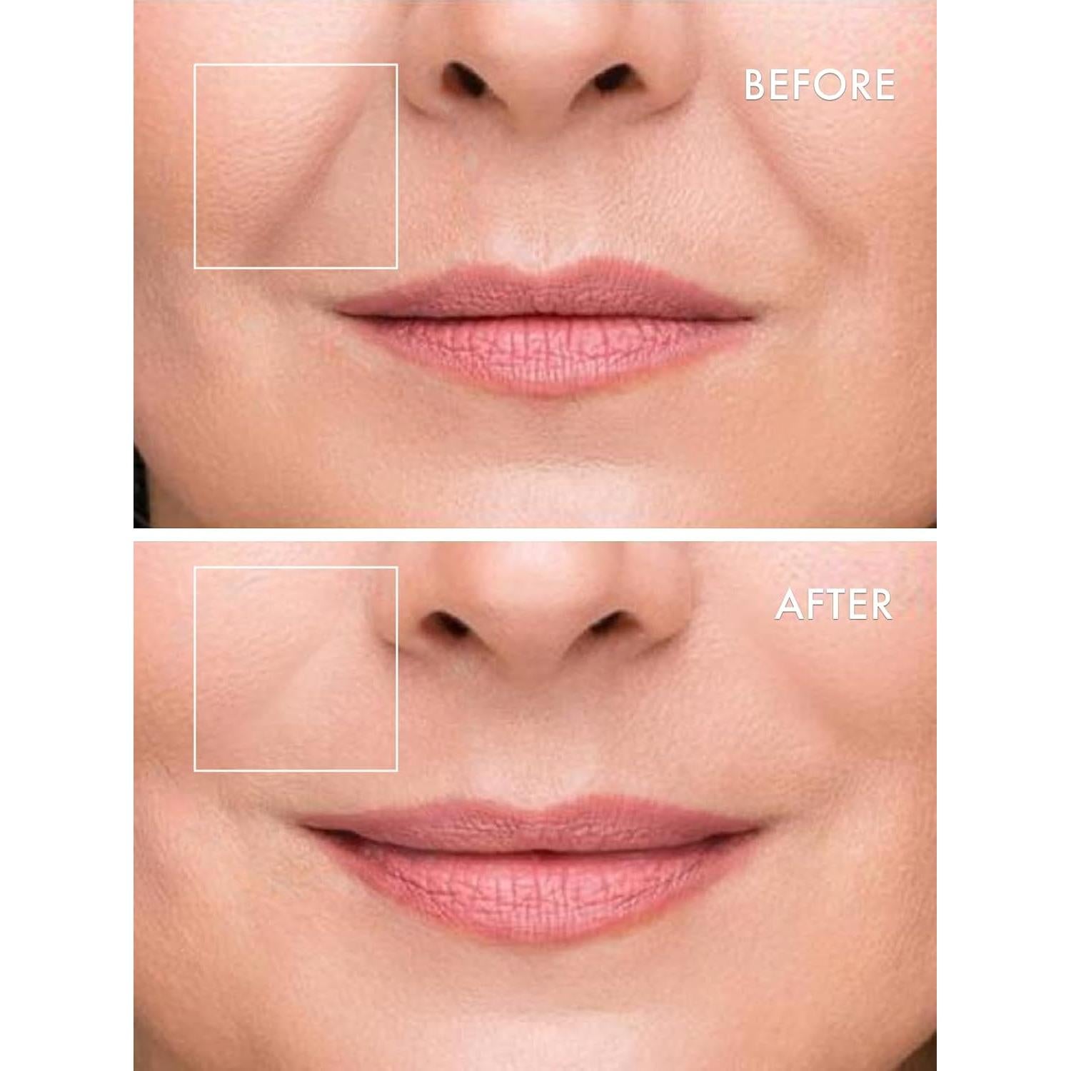 Parche Micro Dart Infundido con Suero Deepcare+ | 4 Pares