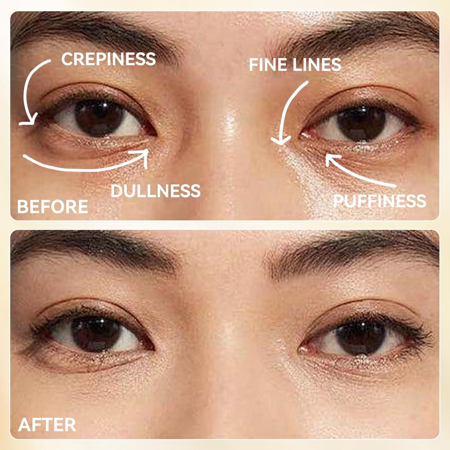 Parches para Ojos LANBENA 24K - Reducción de Bolsas y Arrugas (6 Pares)