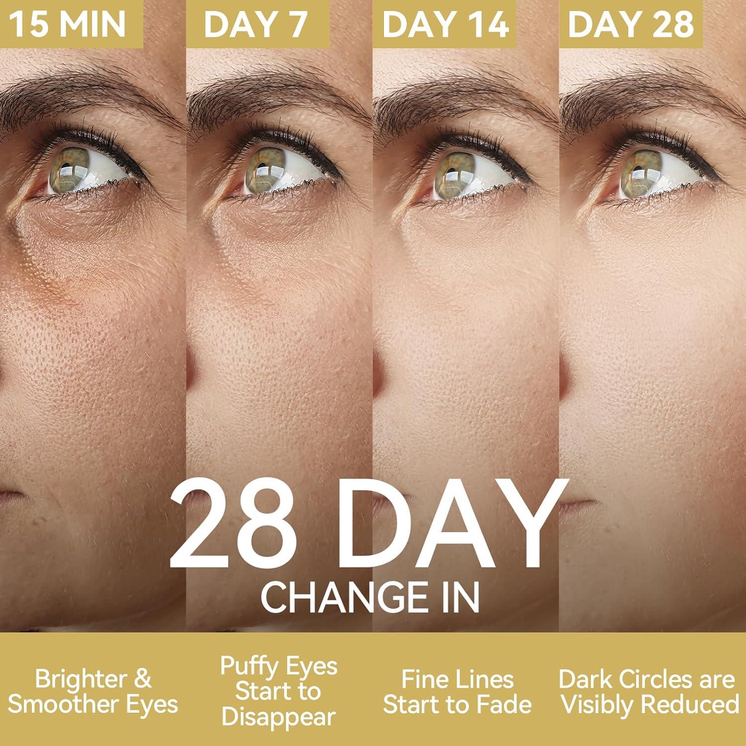 Parches para Ojos LANBENA 24K - Reducción de Bolsas y Arrugas (6 Pares)