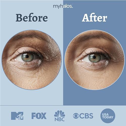 Mascarillas para Ojos MyHalos - 24 Parches Gel Hidratantes