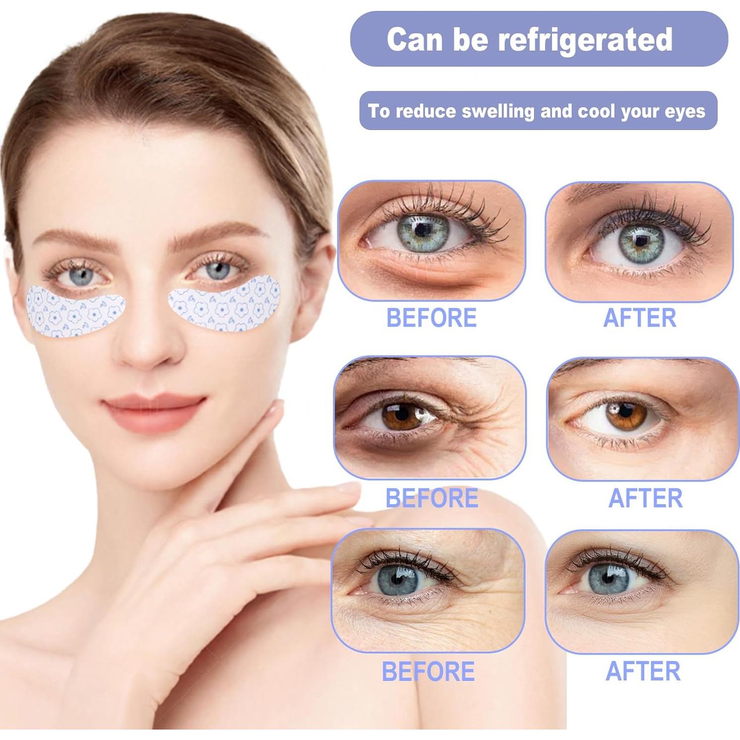 Parche para Ojos Reutilizable Viigunence - 2 Pares Silicona