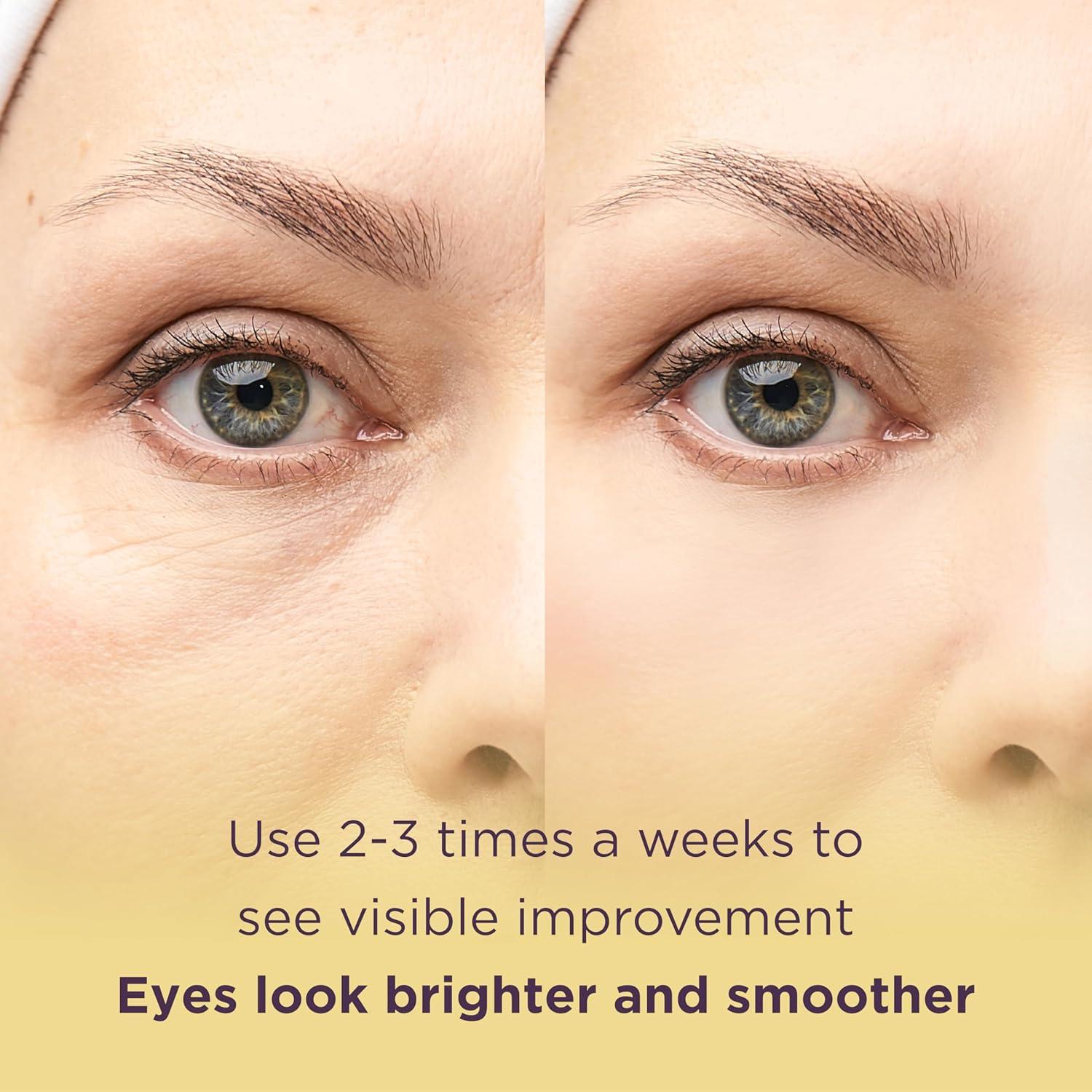 Mascarilla de Ojos de Oro MATKAS - 20 Pares, Anti-Ojeras y Anti-Hinchazón