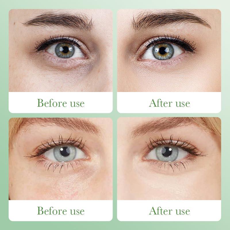 36 Pares de Parche para Ojos y Máscara de Labios Etuanxi