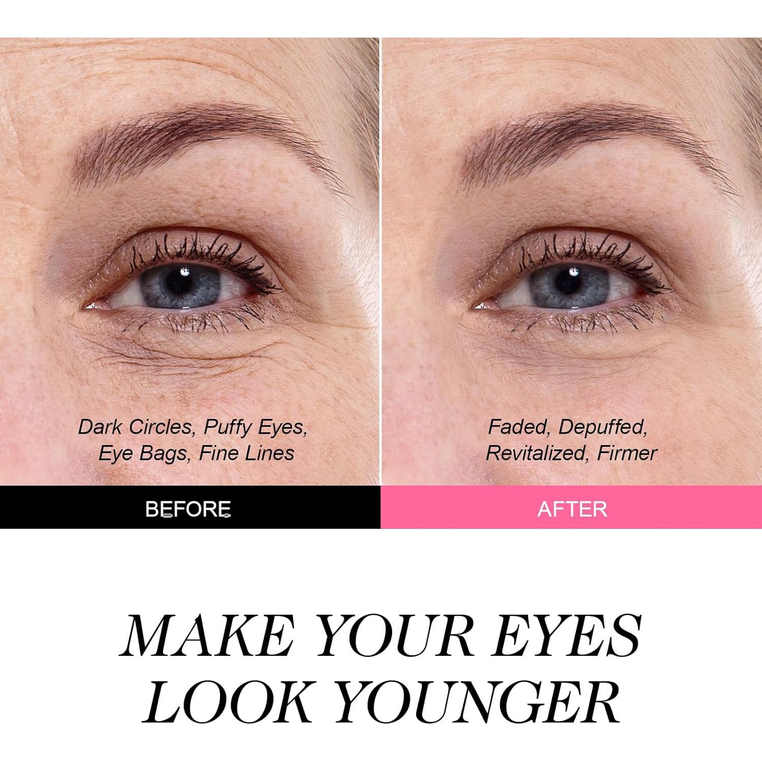 Parches para Ojos ZealSea - 20 Pares Hidrogel Anti-Ojeras