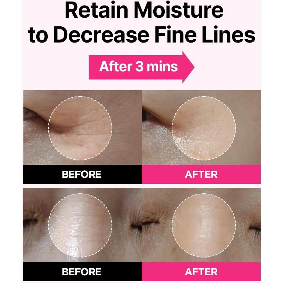 Parches para Ojos ISOI Blemish Care 90 pcs - Hidratación y Antiarrugas