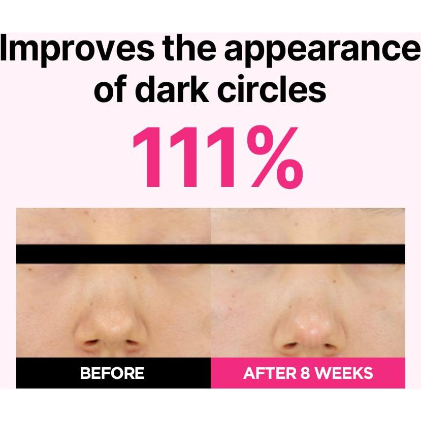 Parches para Ojos ISOI Blemish Care 90 pcs - Hidratación y Antiarrugas