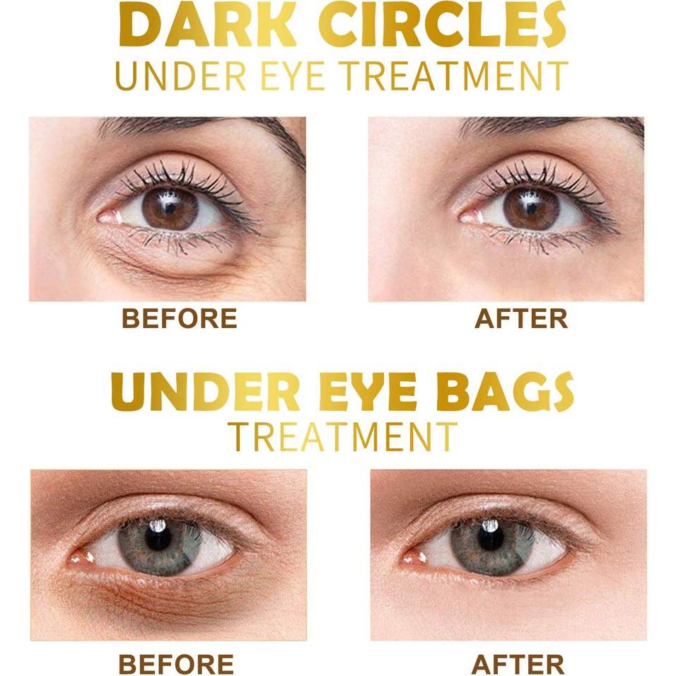 Parche para Ojos Dorado Felico - 30 Pares Colágeno Hidratante