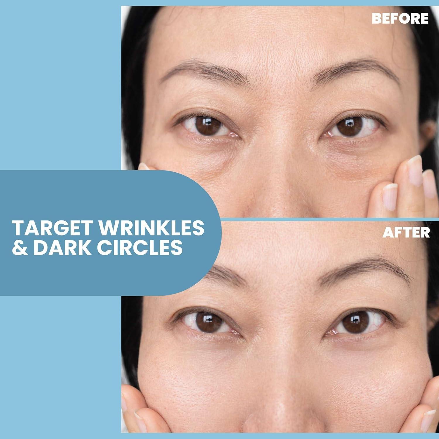 Gel para Ojos Eva Naturals 59 ml - Anti-envejecimiento y Reafirmante