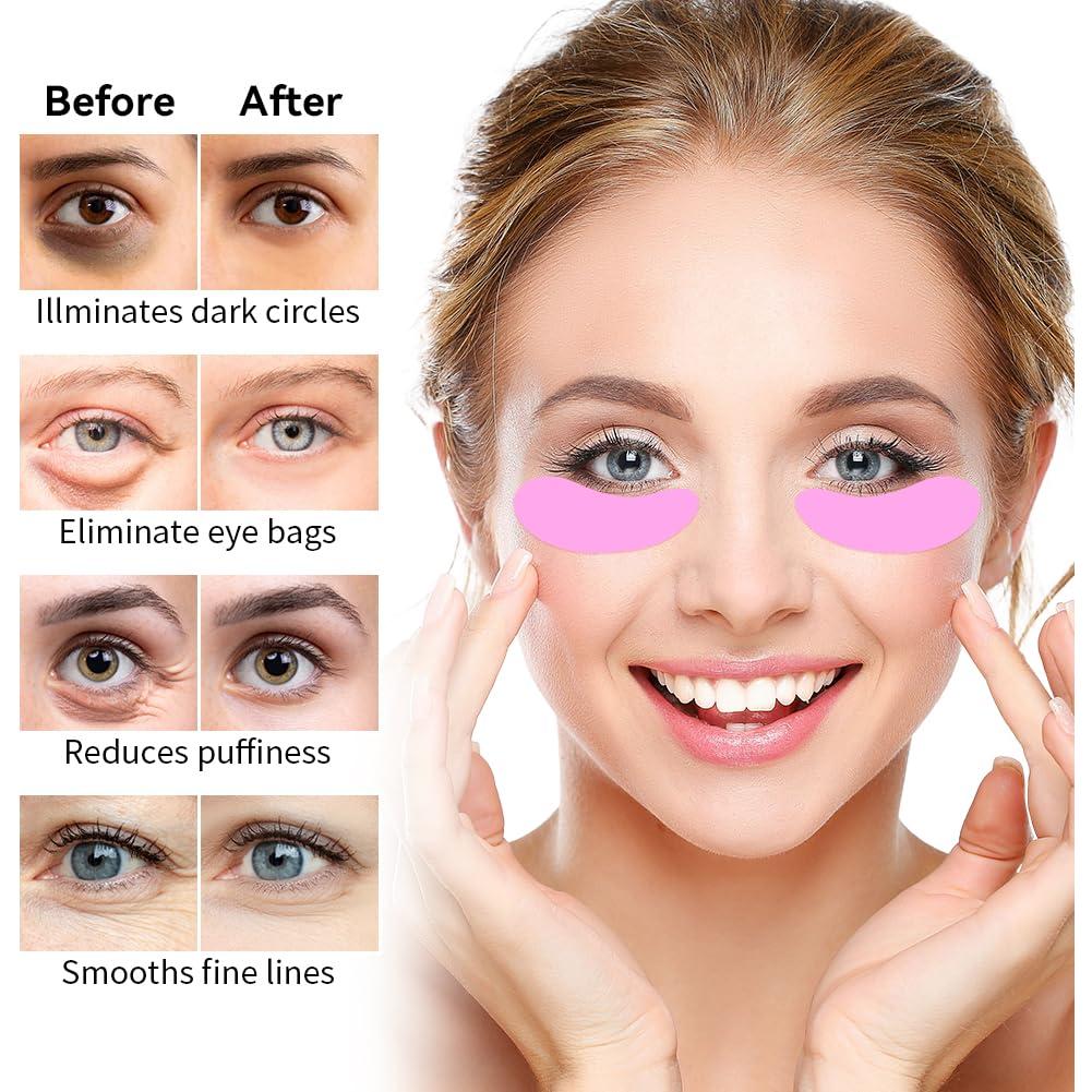 Conjunto de Parches para Ojos Reutilizables Mis Cosas Novedosas - 6 Pares