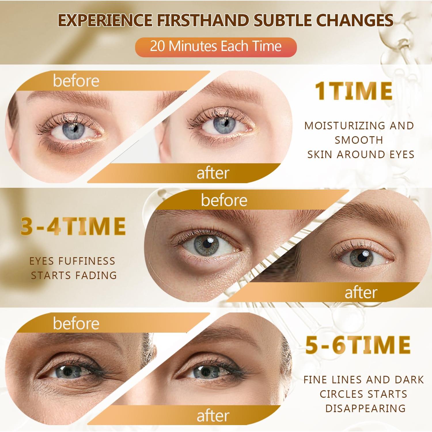 60 Parches de Ojos Hidratantes Yargkos 24K - Anti-Ojeras