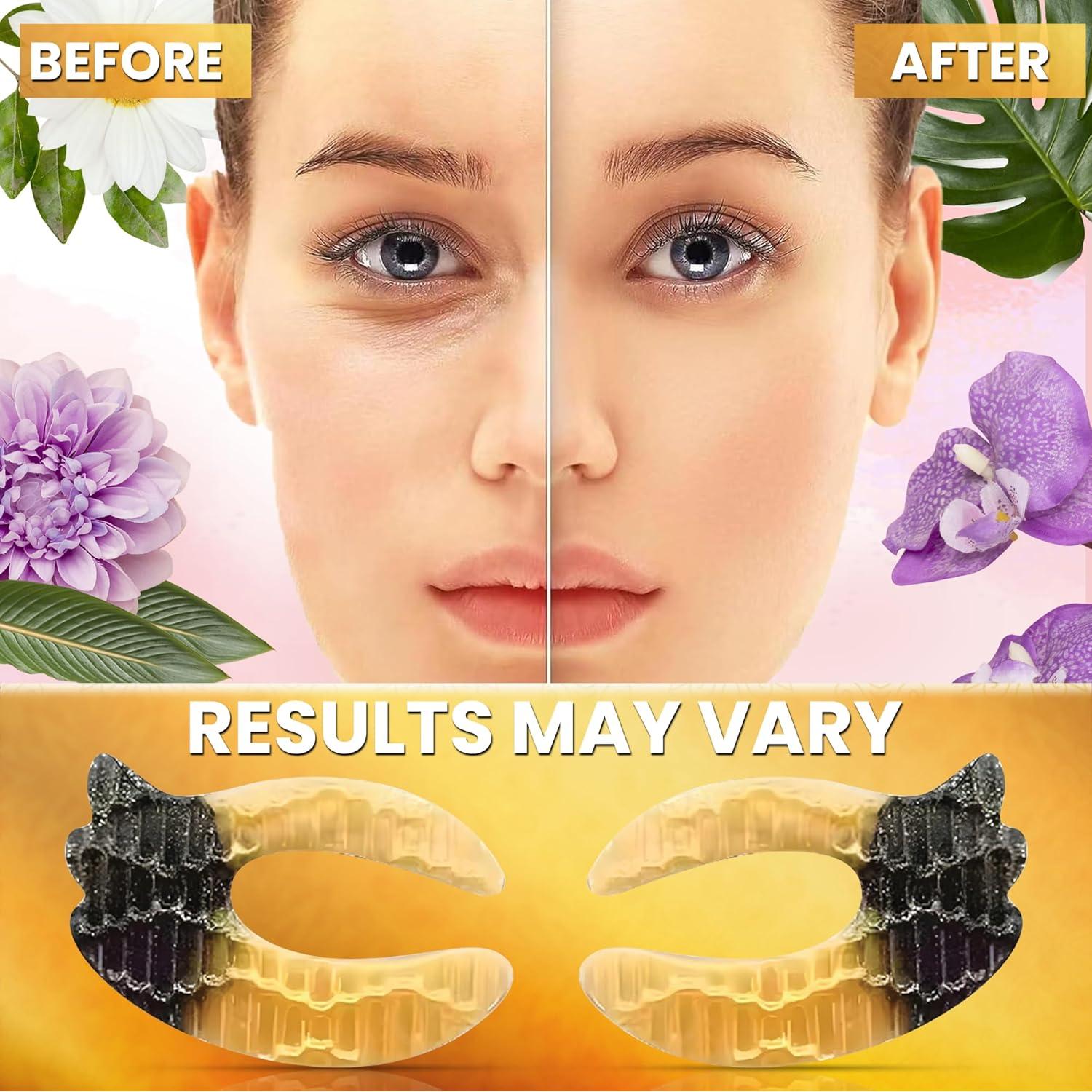 Parche de Gel para Ojos NixFlex - 20 Pares Hidratantes