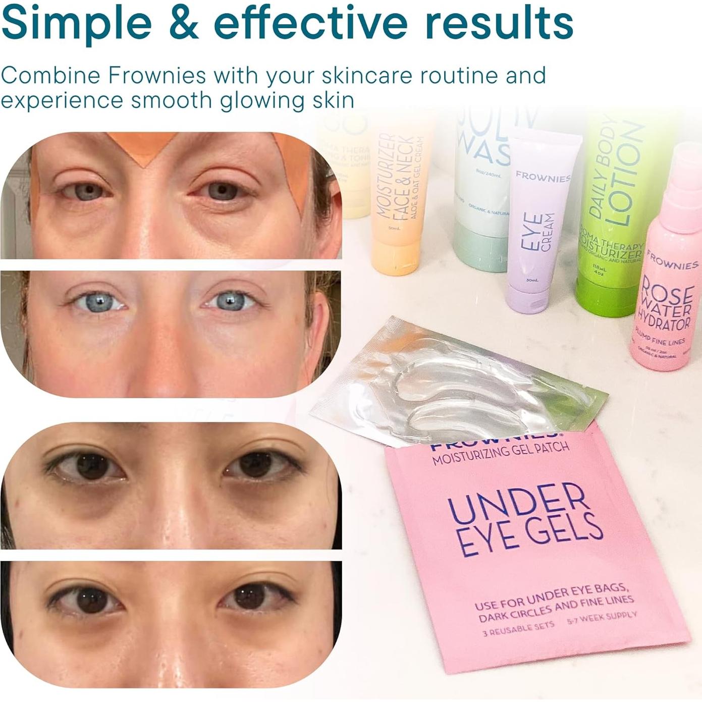 Parche de Gel Frownies para Ojos - Reutilizable, 3 Piezas