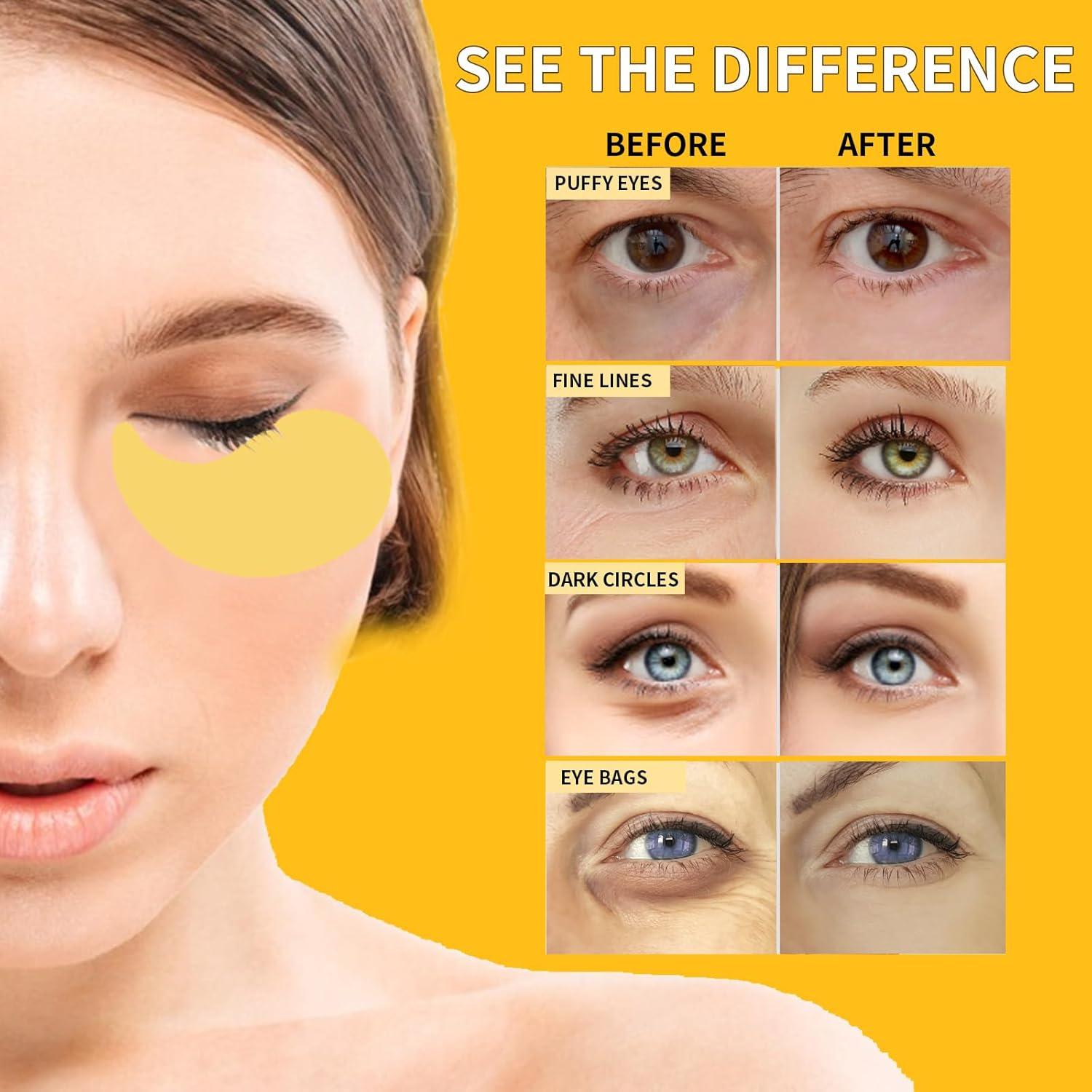 Mascarillas para Ojos de Oro 24K Rywixm - 70 Piezas