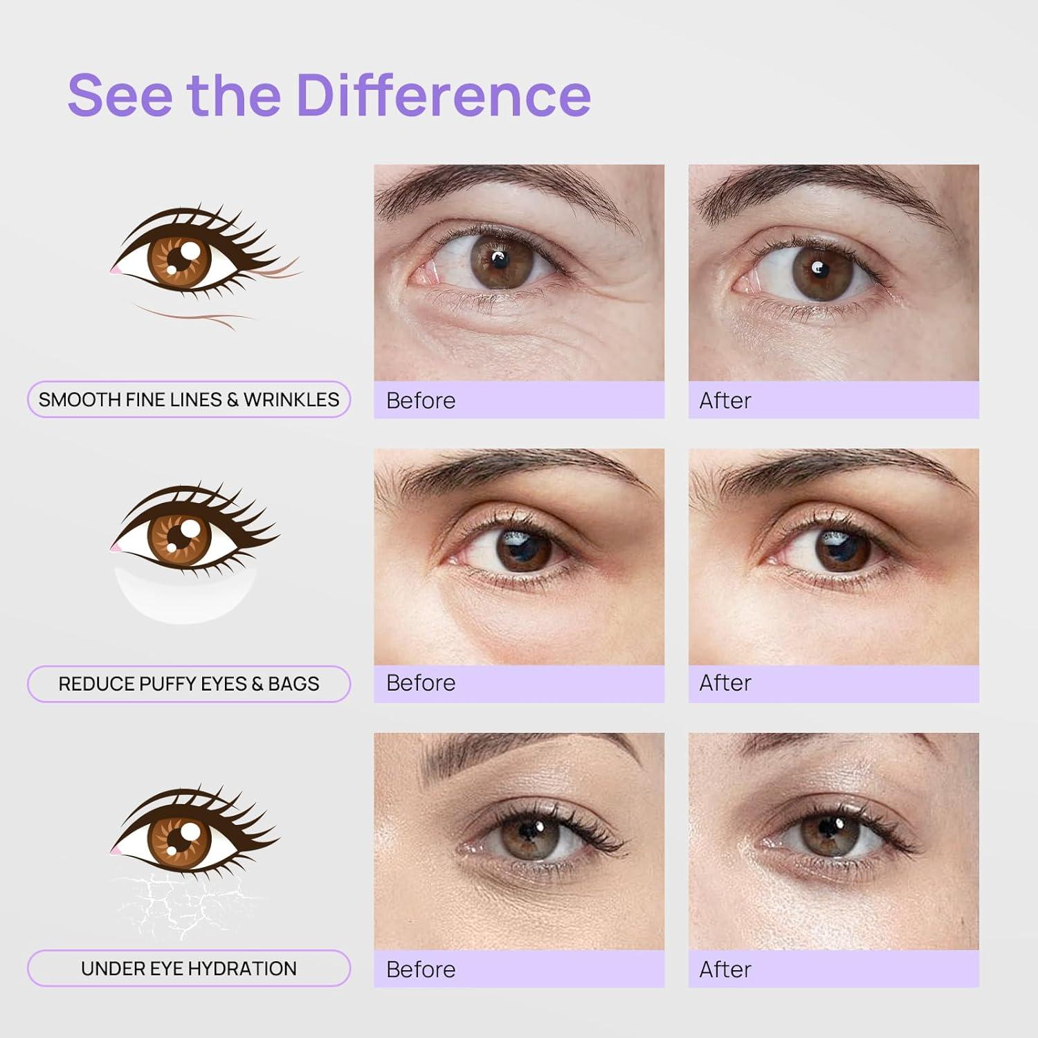 Mascarillas para Ojos Bleuvél - 14 Pares Mucina de Caracol