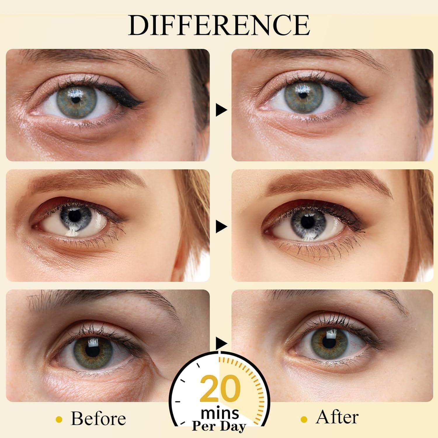 Parche para Ojos Aurchdly 30 Pares Colágeno y Ácido Hialurónico