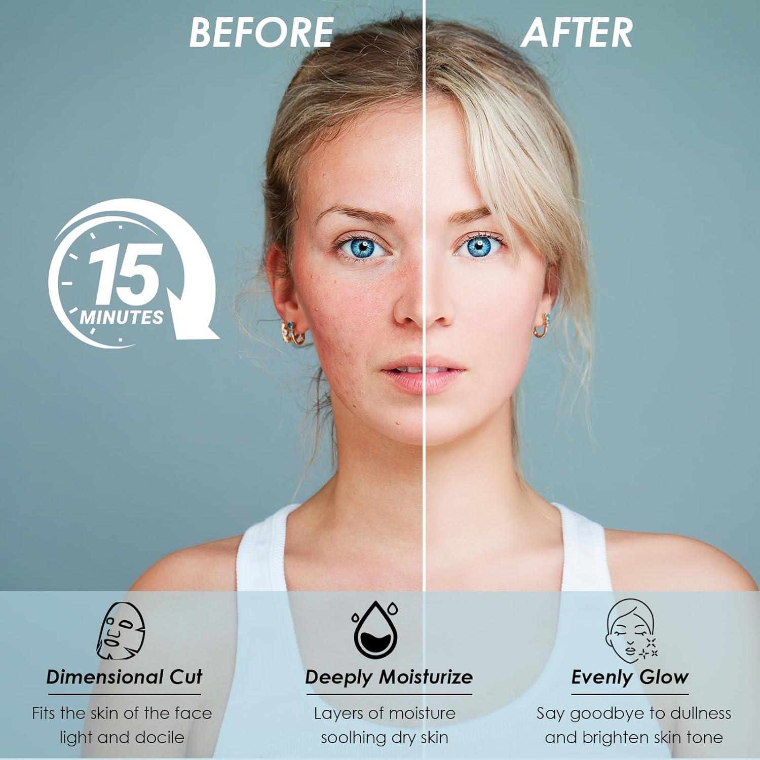 Paquete de 12 Mascarillas Faciales Hidratantes Qullmartle