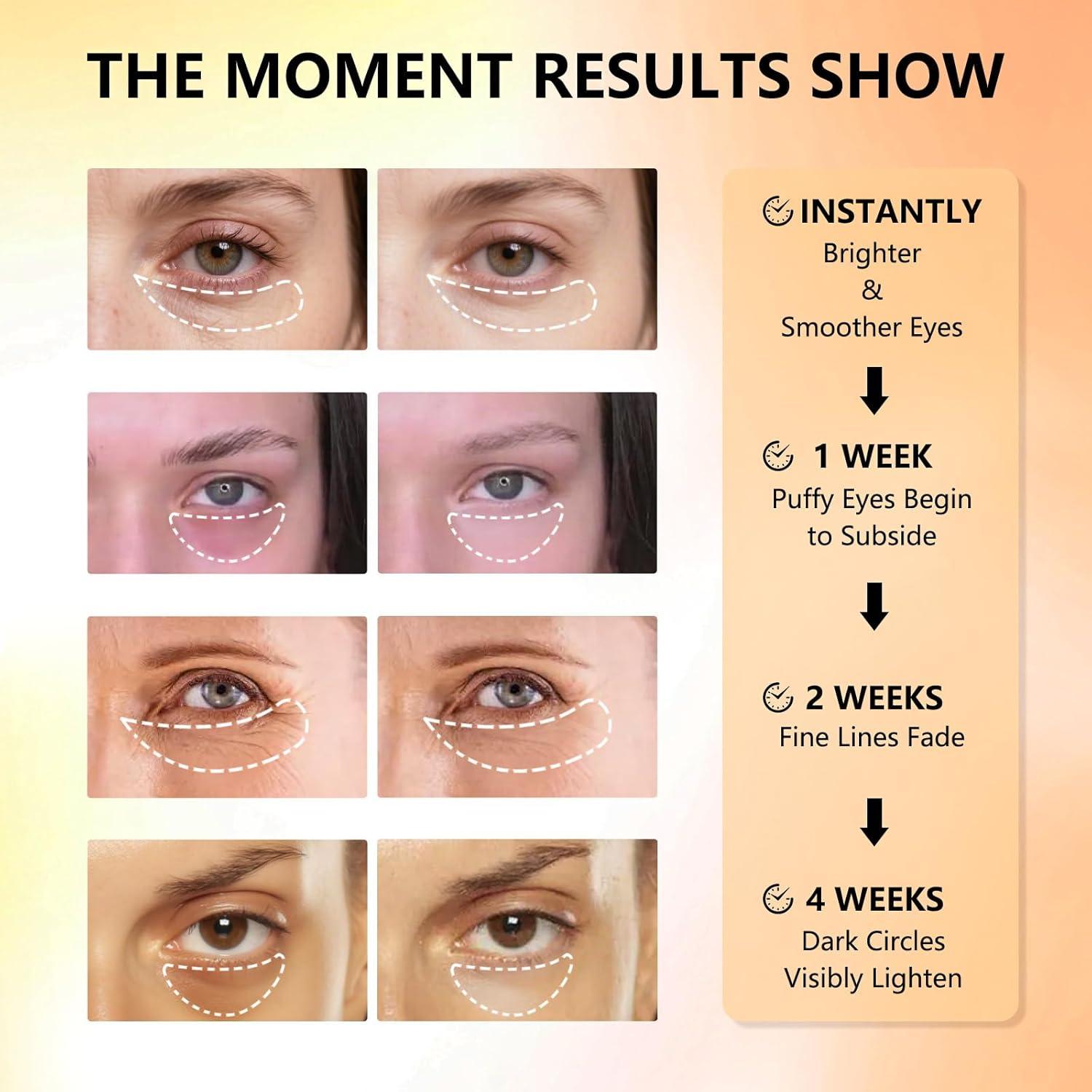 Parches para Ojos Aeryea con Vitamina C y Cafeína - 30 Pares