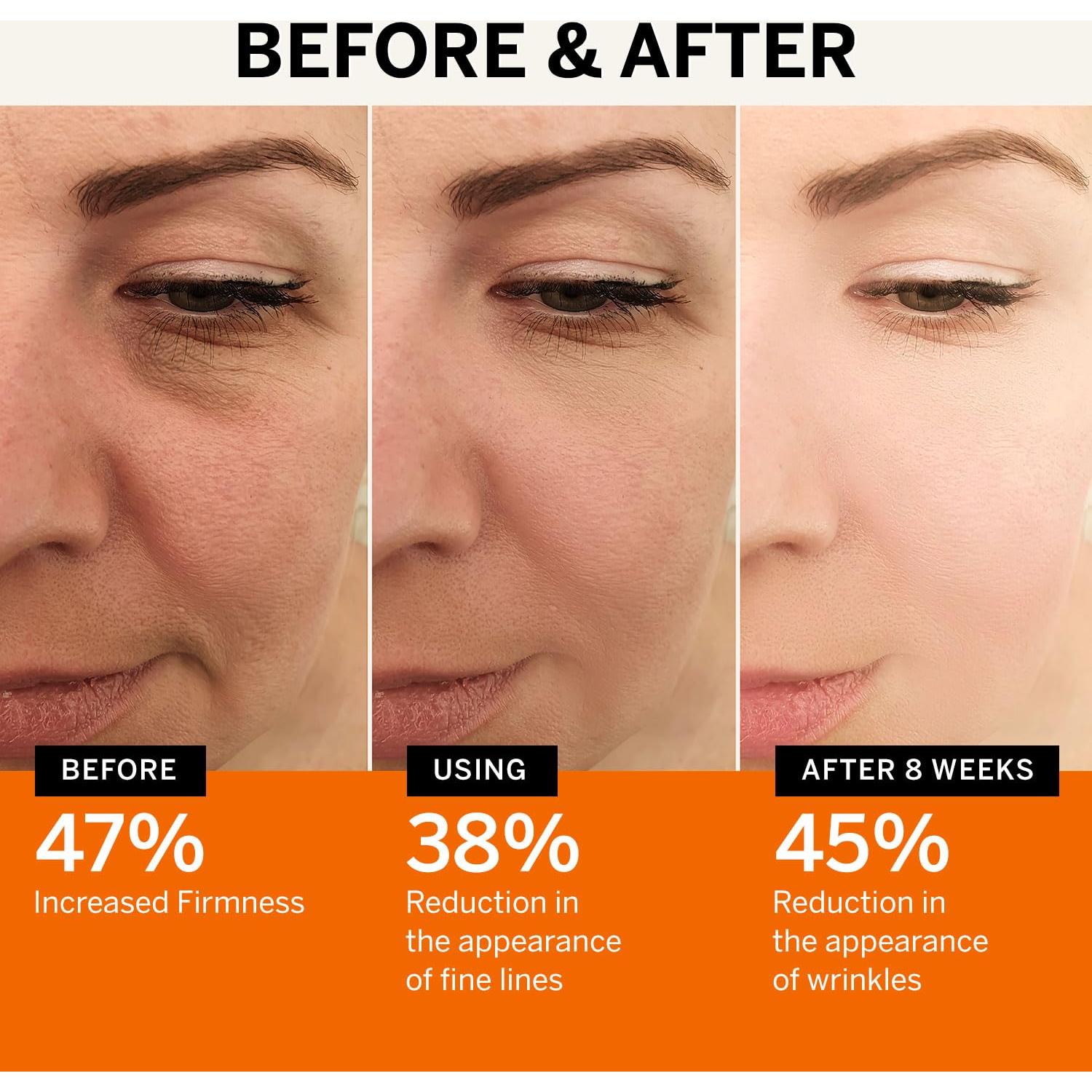 Suero Facial Antienvejecimiento Lupure Vitamina C 150ml