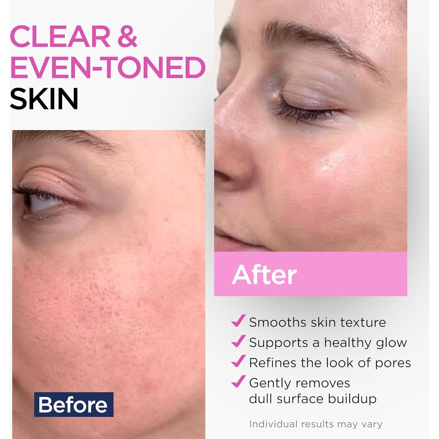 Suero de Ácido Glicólico 15% Ember Cloud 59 ml - Exfoliante Facial