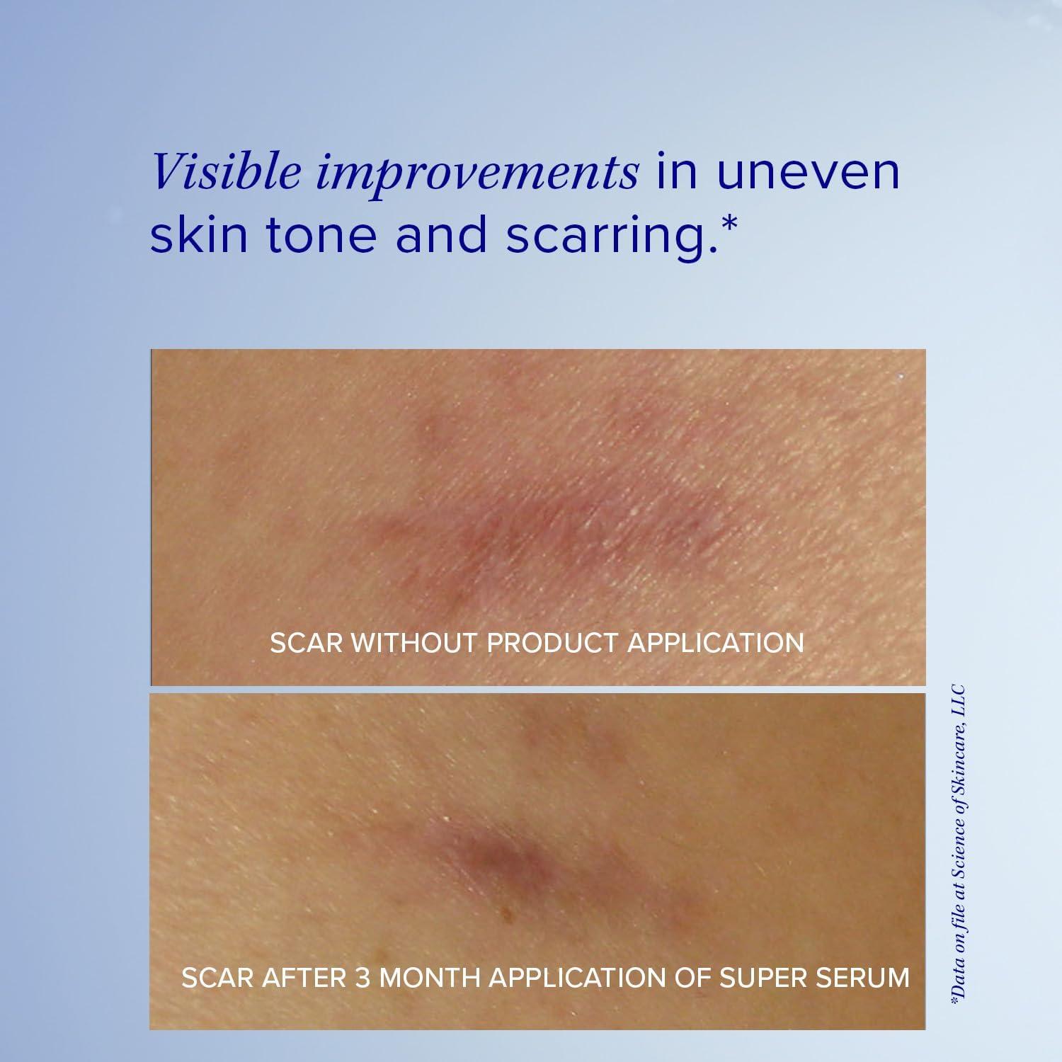 Suero Facial Anti-Envejecimiento iS CLINICAL 14.79 ml