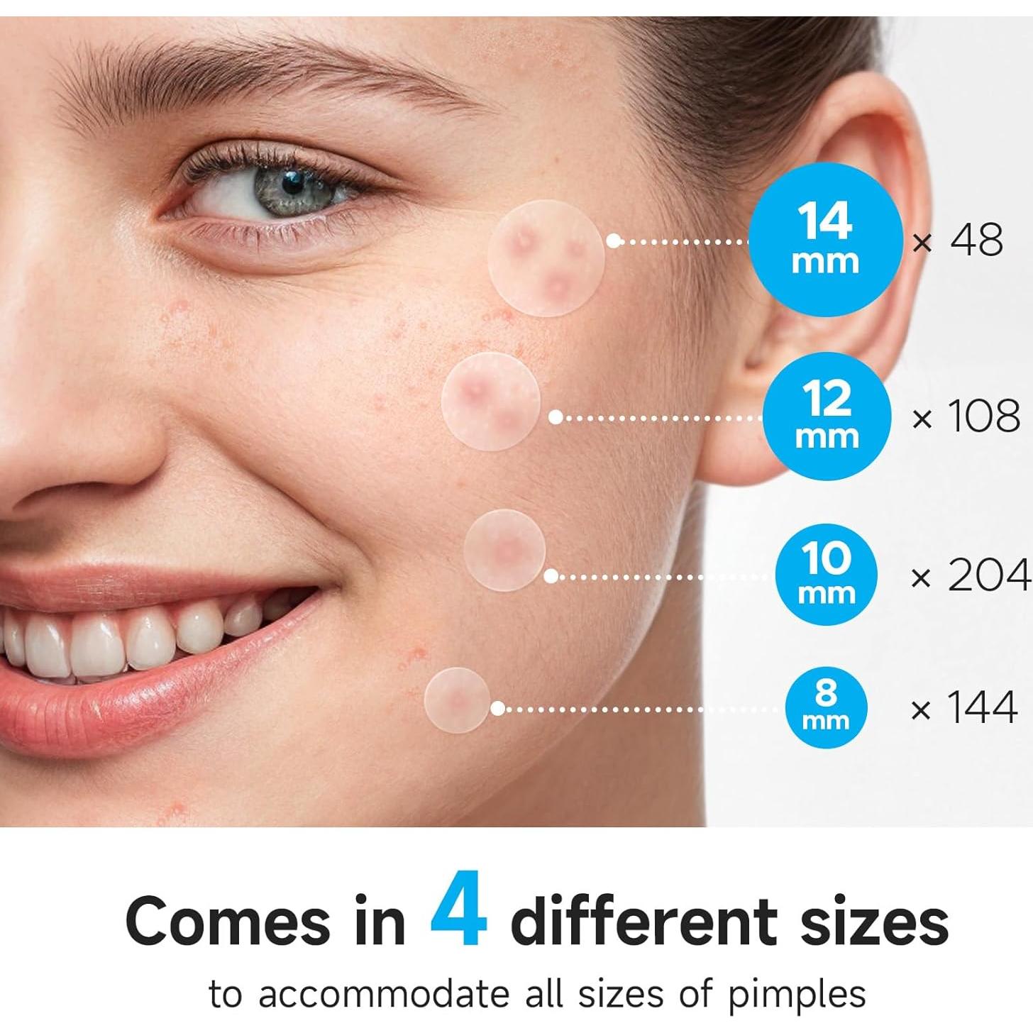 Parche para Granos GlowPatch 504 Unidades Hidrocoloide