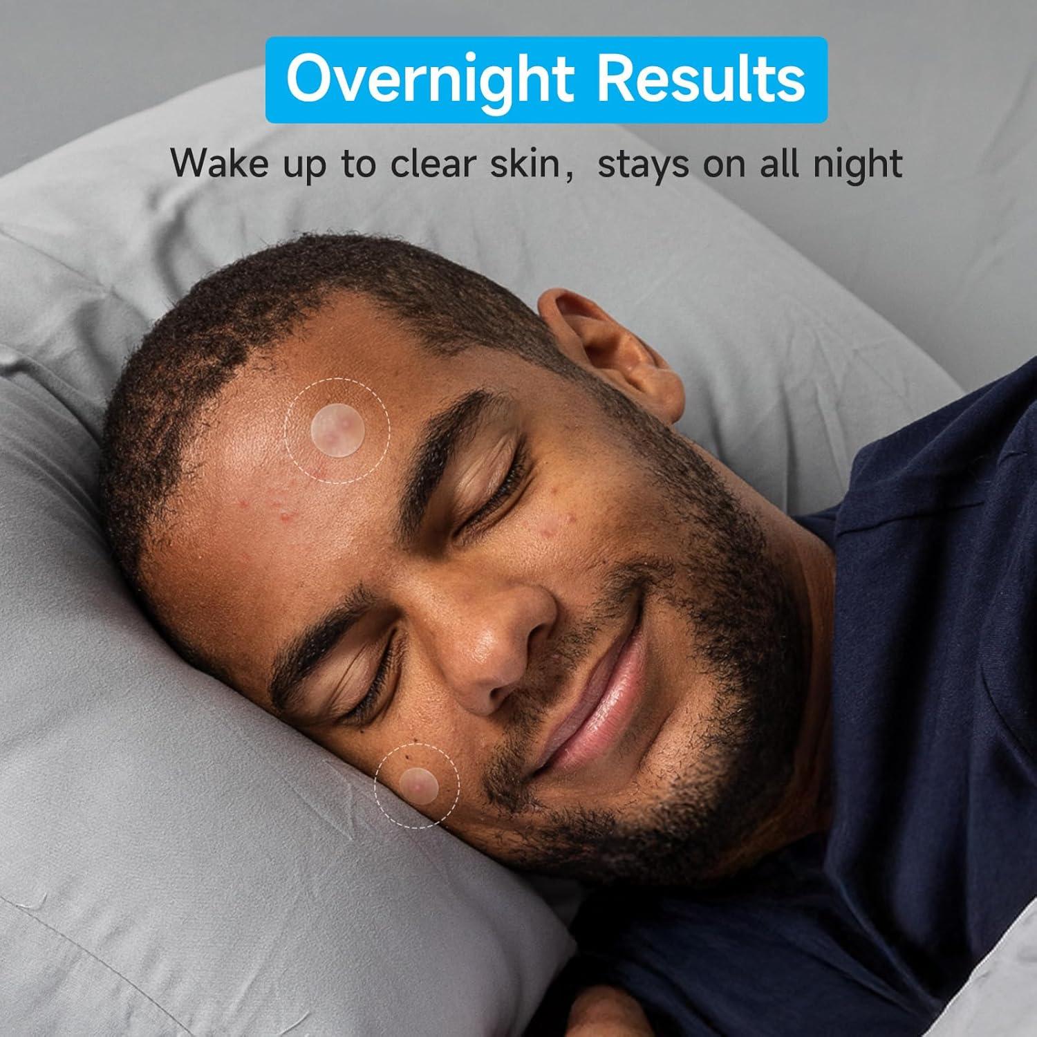 Parche para Granos GlowPatch 504 Unidades Hidrocoloide