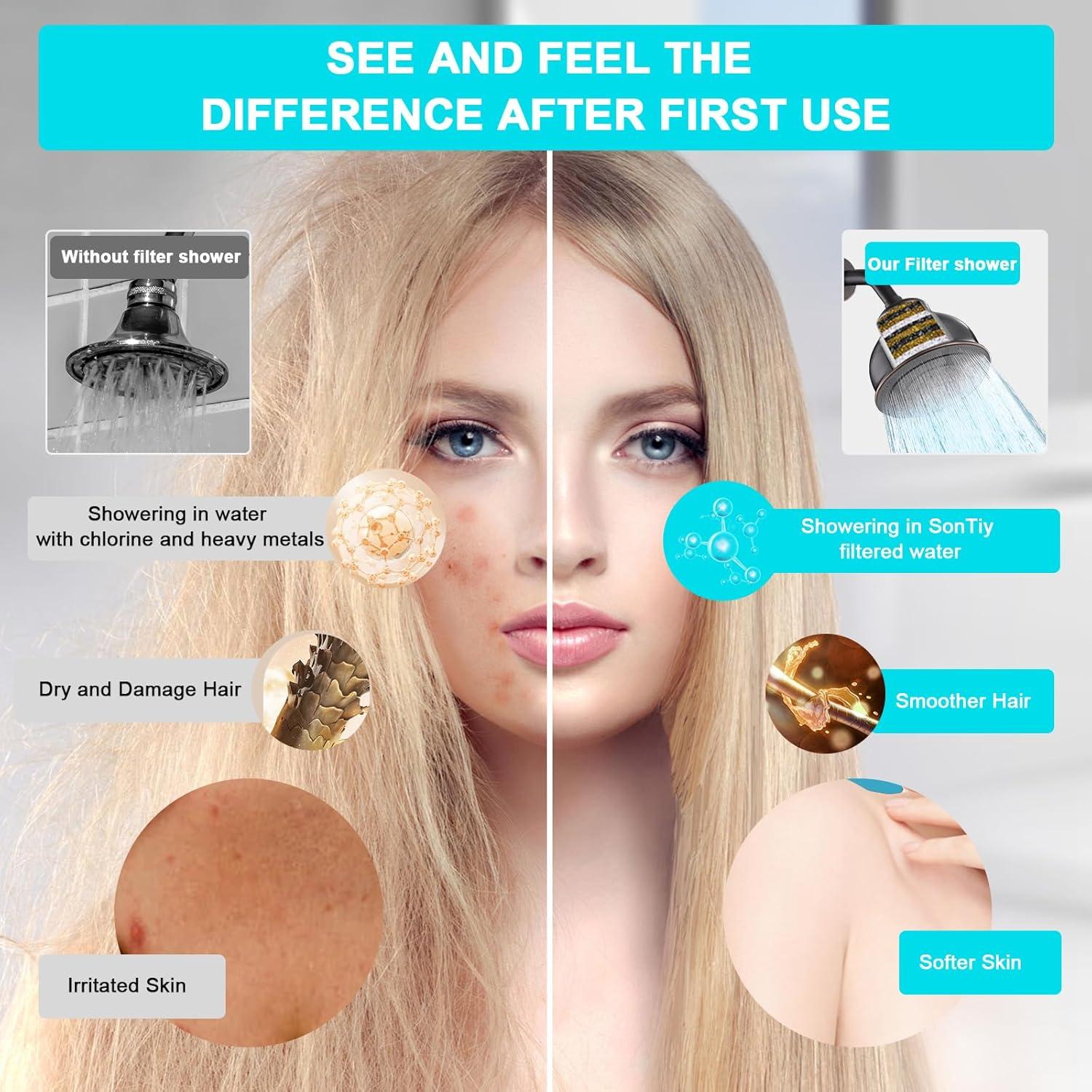 Cabezal de Ducha Filtrado SonTiy 6" Alta Presión Acero Inoxidable