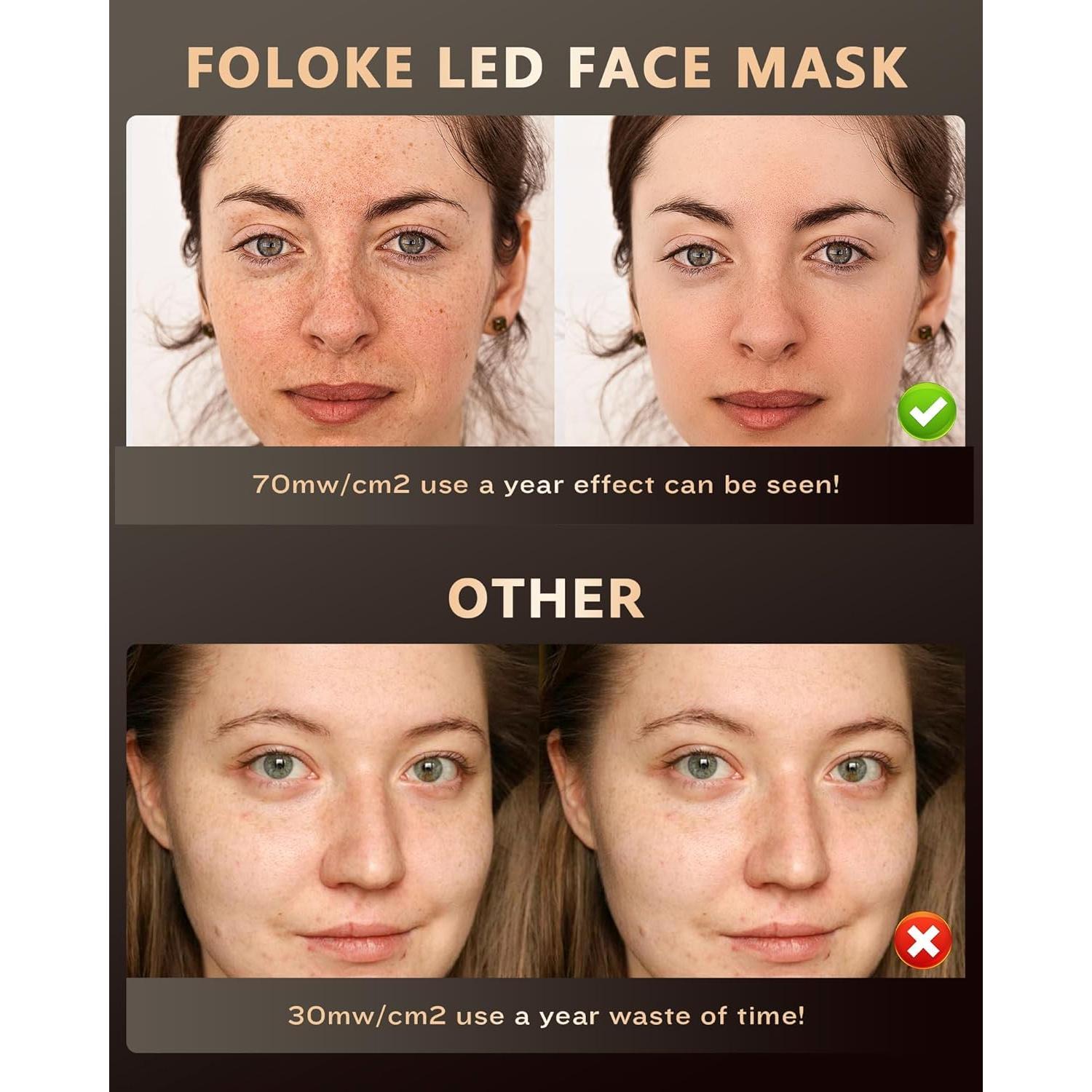 Máscara de Terapia de Luz LED FOLOKE para Cuidado Facial