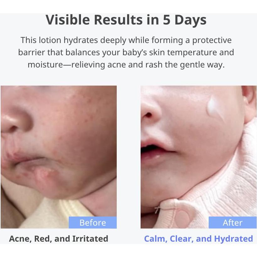 Loción Hidratante Hipoalergénica CHA&MOM para Bebés 240ml