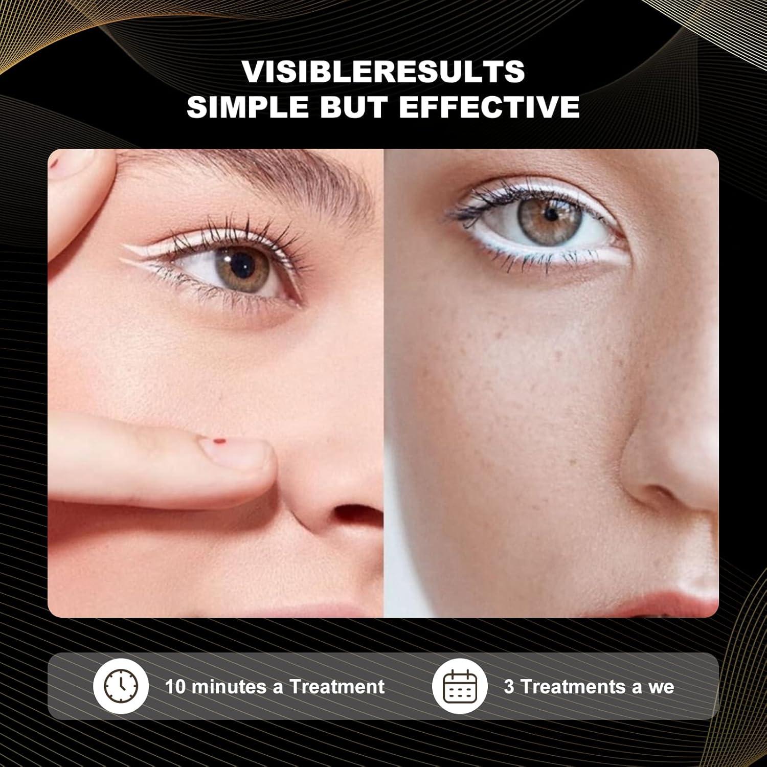 Máscara de Terapia de Luz Facial LED FAHKNS 7 Colores Recargable